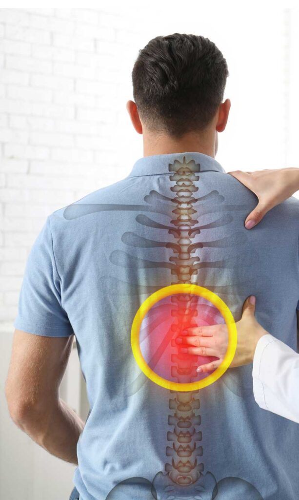Spine Surgeries
