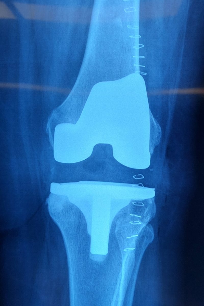 SmartSelect_20221220_181351_Gallery