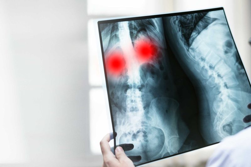 doctor-withpatient-x-ray Spine x-ray
