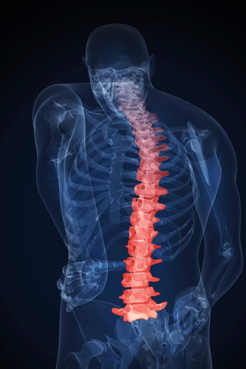 Spine view